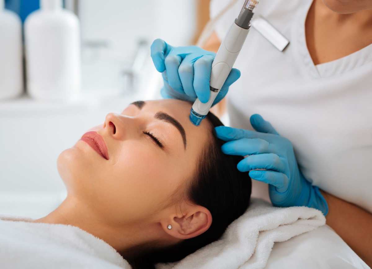 SkinPen Microneedling