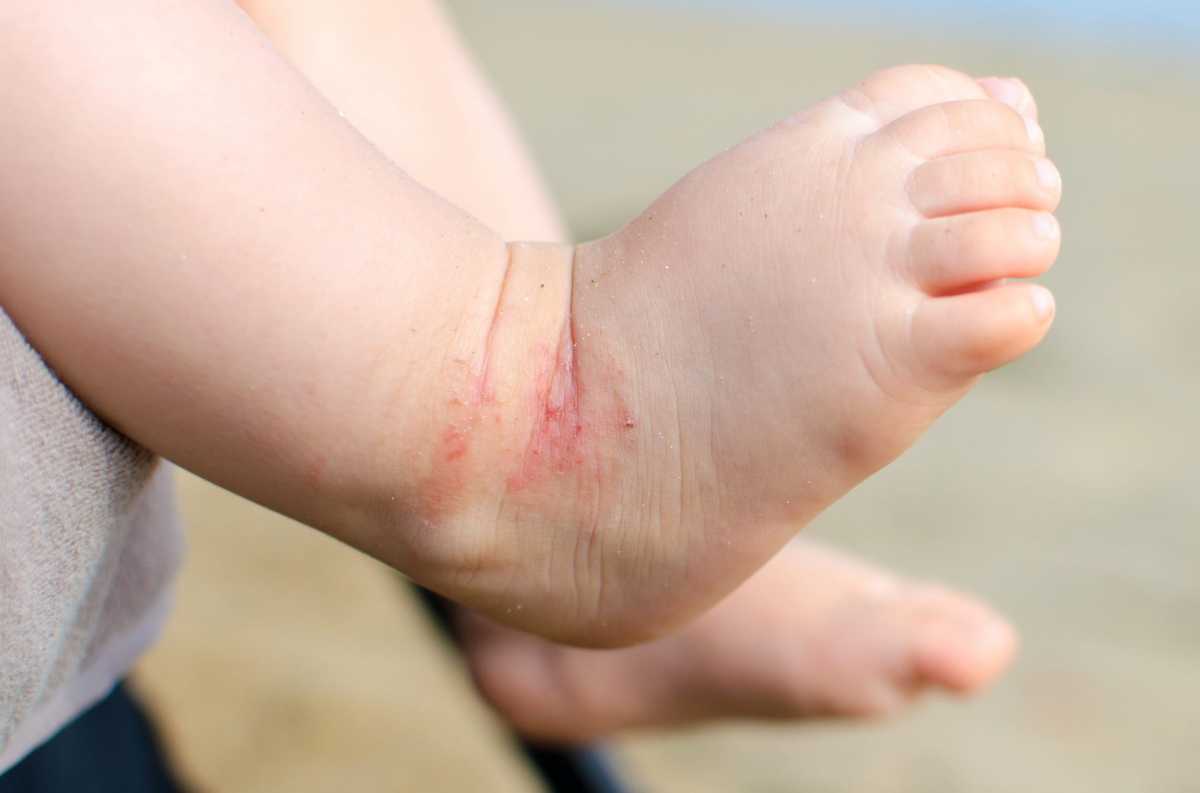 &Alpha;&tau;&omicron;&pi;&iota;&kappa;ή &Delta;&epsilon;&rho;&mu;&alpha;&tau;ί&tau;&iota;&delta;&alpha;