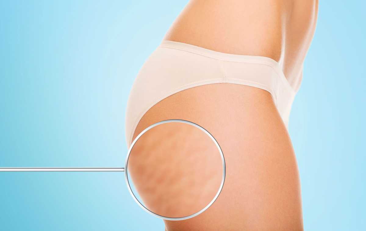 &Theta;&epsilon;&rho;&alpha;&pi;&epsilon;ί&epsilon;&sigmaf; &kappa;&alpha;&tau;ά &tau;&eta;&sigmaf; &kappa;&upsilon;&tau;&tau;&alpha;&rho;ί&tau;&iota;&delta;&alpha;&sigmaf;