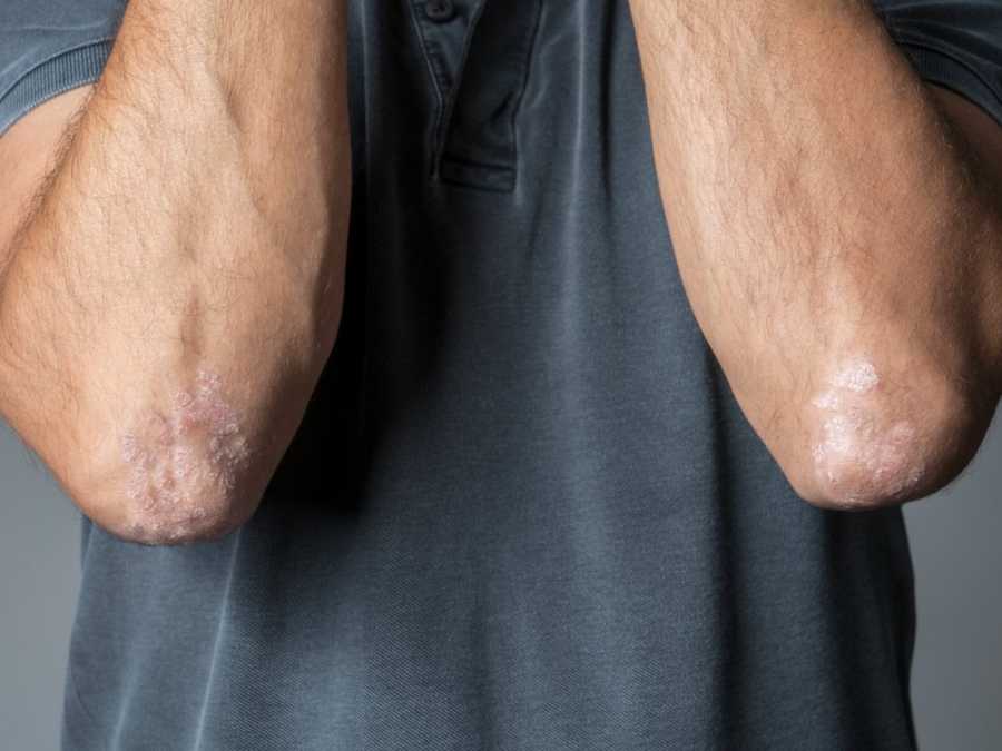 &Pi;ώ&sigmaf; &sigma;&upsilon;&nu;&delta;έ&epsilon;&tau;&alpha;&iota; &eta; &upsilon;&gamma;&epsilon;ί&alpha; &tau;&omicron;&upsilon; &epsilon;&nu;&tau;έ&rho;&omicron;&upsilon; &mu;&epsilon; &tau;&eta;&nu; &psi;&omega;&rho;ί&alpha;&sigma;&eta; &kappa;&alpha;&iota; &pi;&omicron;&iota;&omicron;&sigmaf; &omicron; &rho;ό&lambda;&omicron;&sigmaf; &tau;&omicron;&upsilon; &epsilon;&nu;&tau;&epsilon;&rho;&iota;&kappa;&omicron;ύ &mu;&iota;&kappa;&rho;&omicron;&beta;&iota;ώ&mu;&alpha;&tau;&omicron;&sigmaf;;