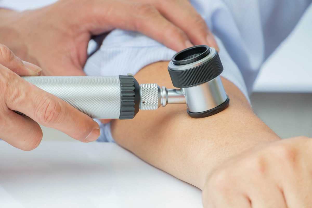 &Alpha;&kappa;&tau;&iota;&nu;&iota;&kappa;έ&sigmaf; &upsilon;&pi;&epsilon;&rho;&kappa;&epsilon;&rho;&alpha;&tau;ώ&sigma;&epsilon;&iota;&sigmaf;