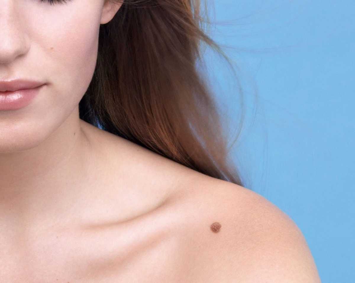 &Mu;&epsilon;&lambda;&alpha;&nu;&omicron;&kappa;&upsilon;&tau;&tau;&alpha;&rho;&iota;&kappa;&omicron;ί &sigma;&pi;ί&lambda;&omicron;&iota; (&epsilon;&lambda;&iota;έ&sigmaf;)