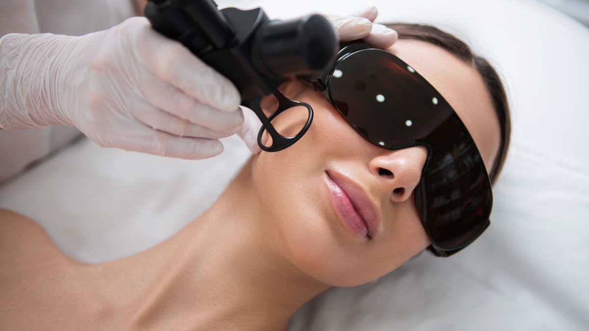 &Alpha;&nu;ά&pi;&lambda;&alpha;&sigma;&eta; &Pi;&rho;&omicron;&sigma;ώ&pi;&omicron;&upsilon; &mu;&epsilon; Fractional laser CO2 (&Alpha;&nu;&tau;&iota;&gamma;ή&rho;&alpha;&nu;&sigma;&eta;, &Omicron;&upsilon;&lambda;έ&sigmaf; &Alpha;&kappa;&mu;ή&sigmaf;)